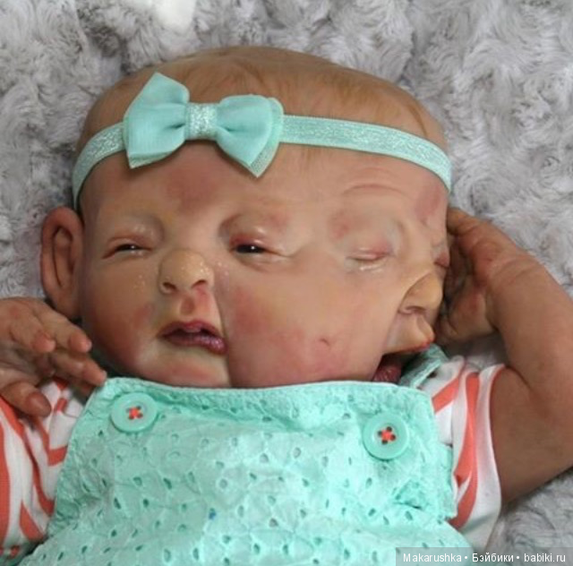 Куклы, изображающие физические отклонения