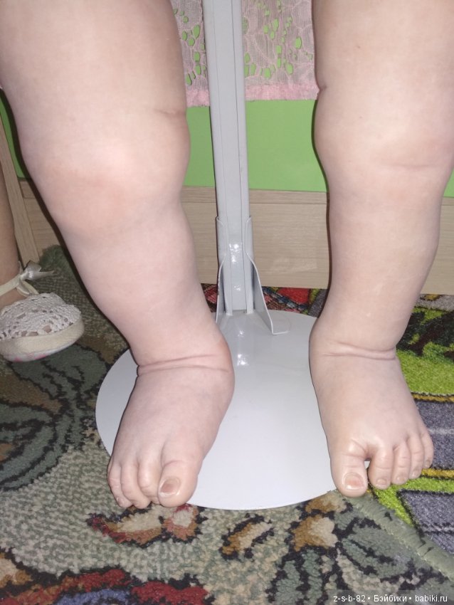 Деформация конечностей у тодлеров. Помогите исправить (фото 6)