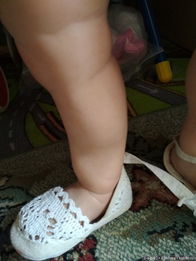 Деформация конечностей у тодлеров. Помогите исправить (фото 2)