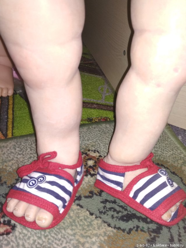 Деформация конечностей у тодлеров. Помогите исправить (фото 7)