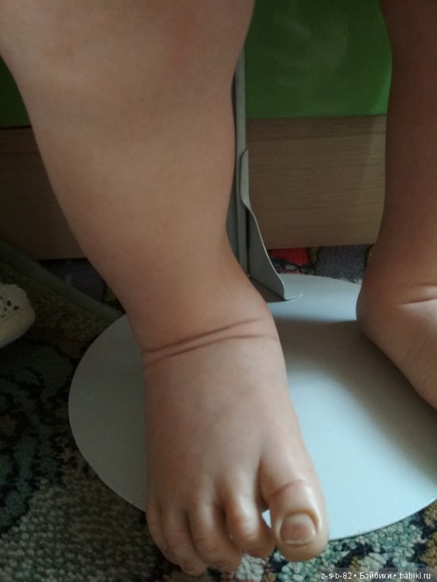 Деформация конечностей у тодлеров. Помогите исправить (фото 5)