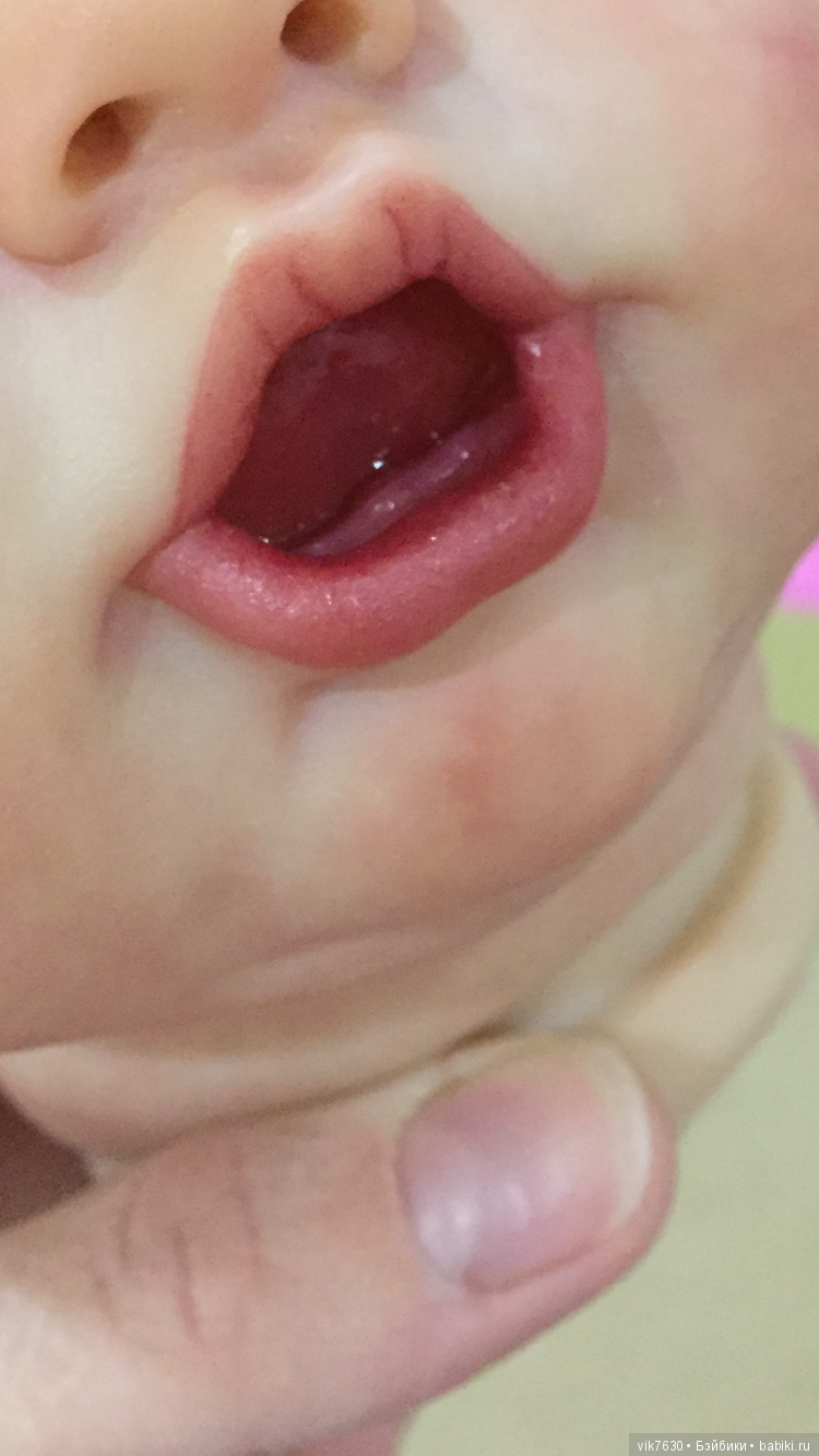 Gertie в процессе возрождения