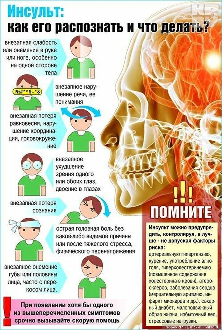 Санбюллетень инсульт в картинках