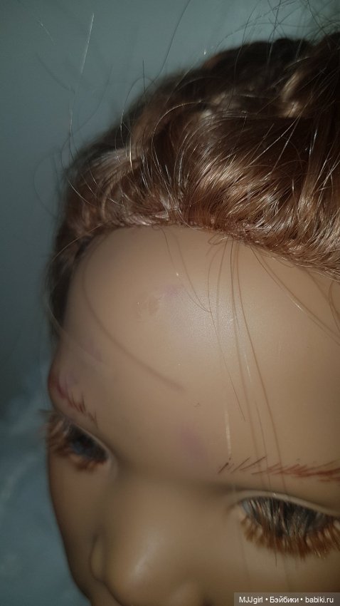 Пятна на лице химки (продолжение)