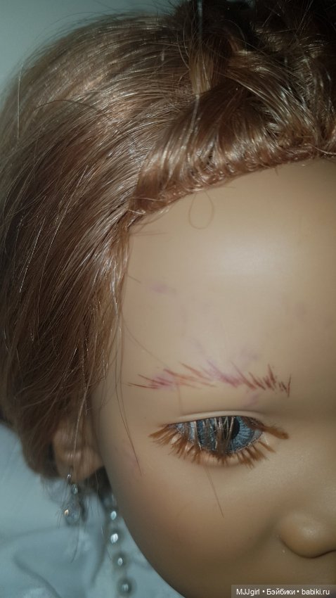 Пятна на лице химки (продолжение) (фото 2)