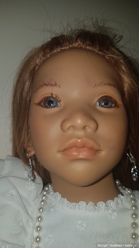 Пятна на лице химки (продолжение) (фото 3)