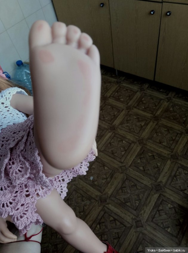Мой опыт борьбы с пятнами