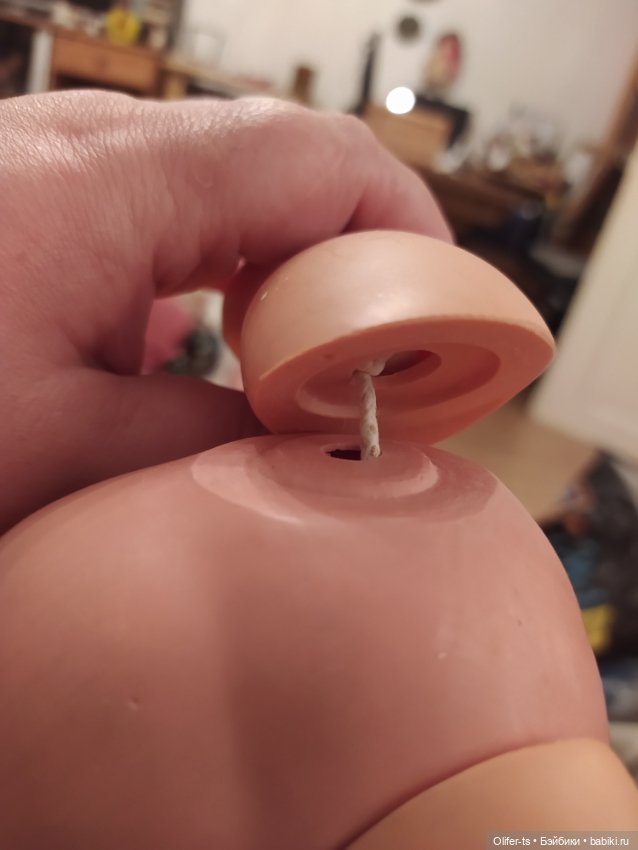 Пожалуйста, подскажите, как лечить такие ноги (фото 3)