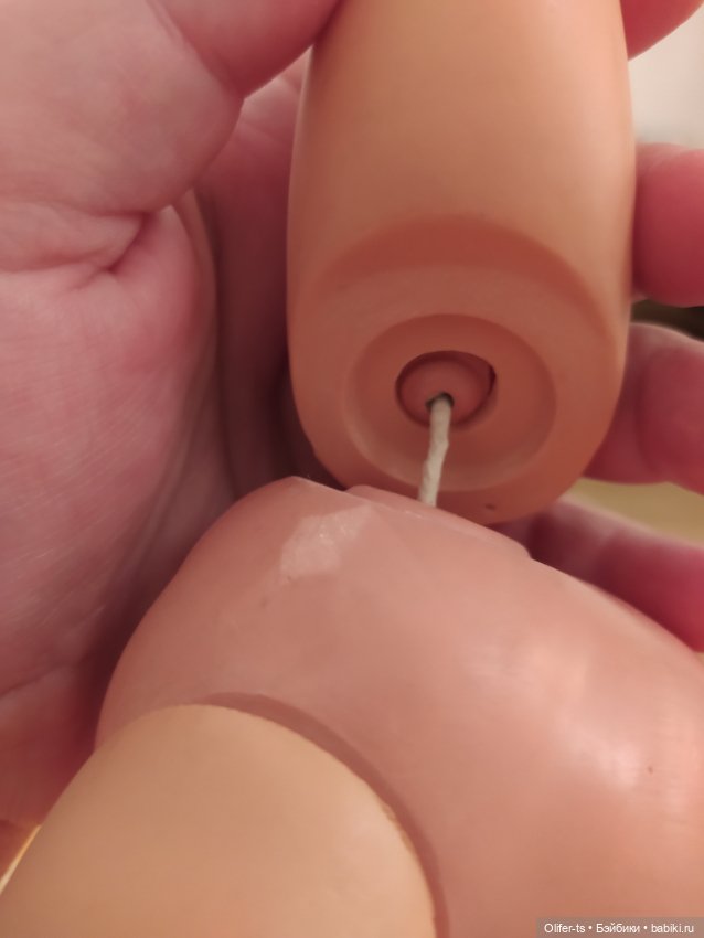 Пожалуйста, подскажите, как лечить такие ноги