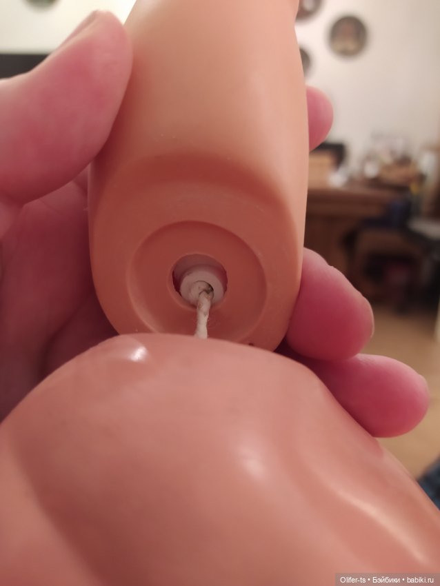 Пожалуйста, подскажите, как лечить такие ноги (фото 2)