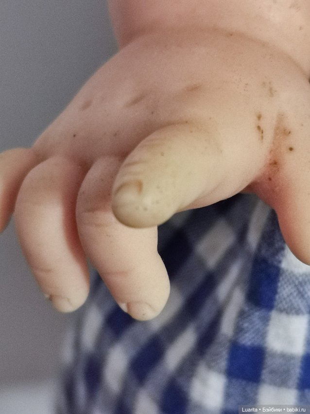 Как вылечить кукольное акне (фото 4)