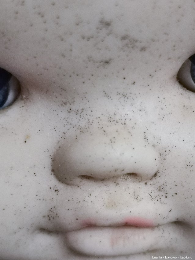 Как вылечить кукольное акне (фото 5)