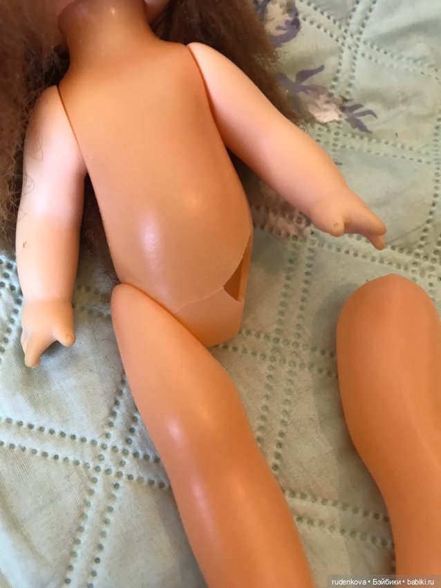 Прошу помощи в лечении подружки детства (фото 6)