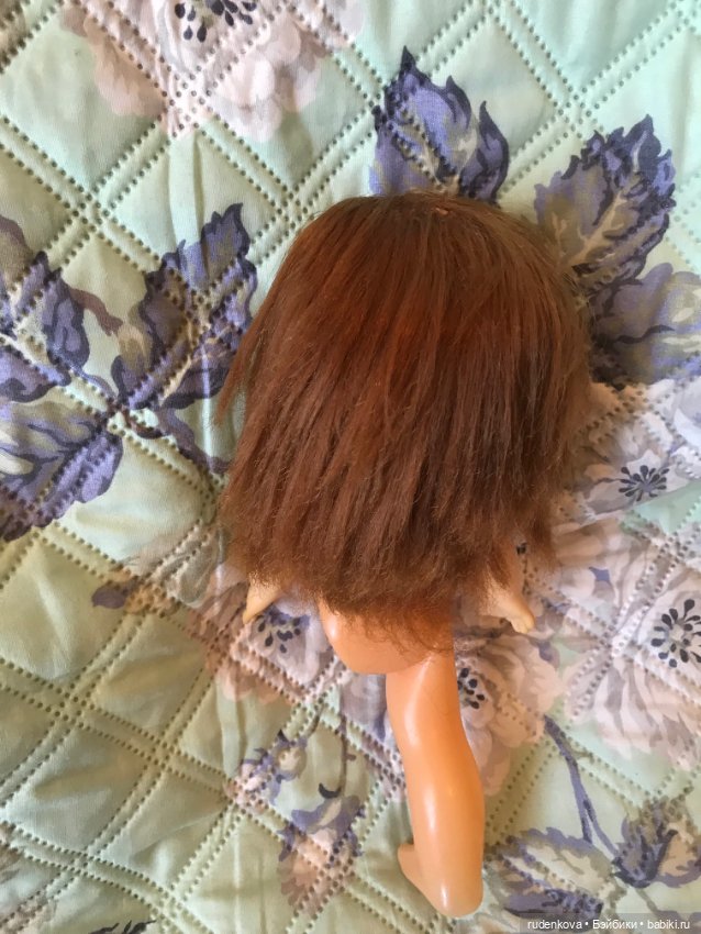 Прошу помощи в лечении подружки детства (фото 3)