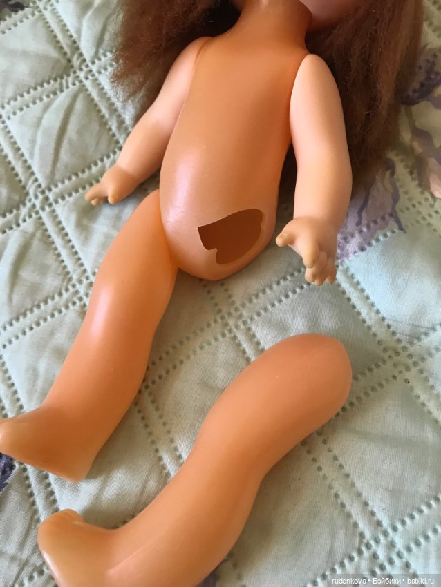 Прошу помощи в лечении подружки детства (фото 7)