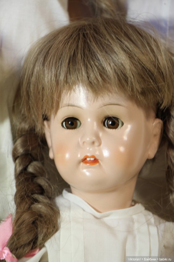 Wernicke. Продолжают приезжать (фото 10)