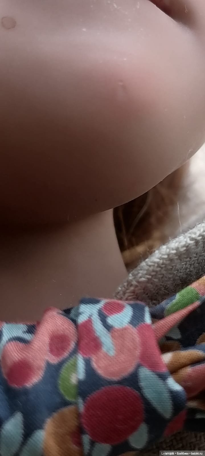 Девочки, Прошу помощи!!! Цвергназе (фото 2)