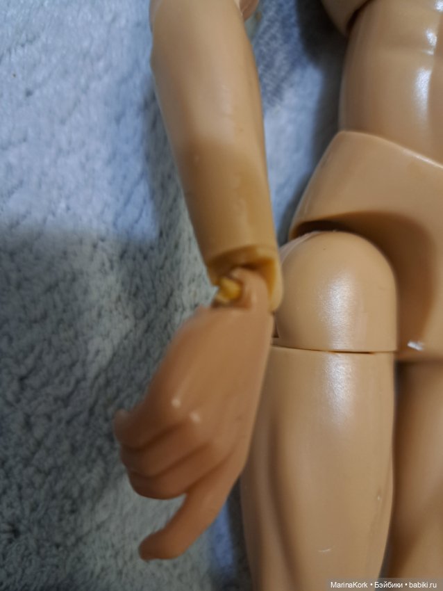 Прошу помощи в пересадке головы или ног (фото 3)