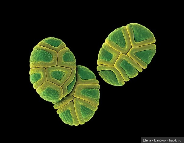 Пыльца под микроскопом от Роберта Кесселера (фото 5)