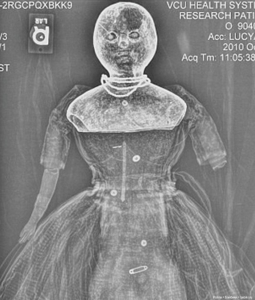 Загадочные куклы-путешественницы под рентгеном (фото 4)