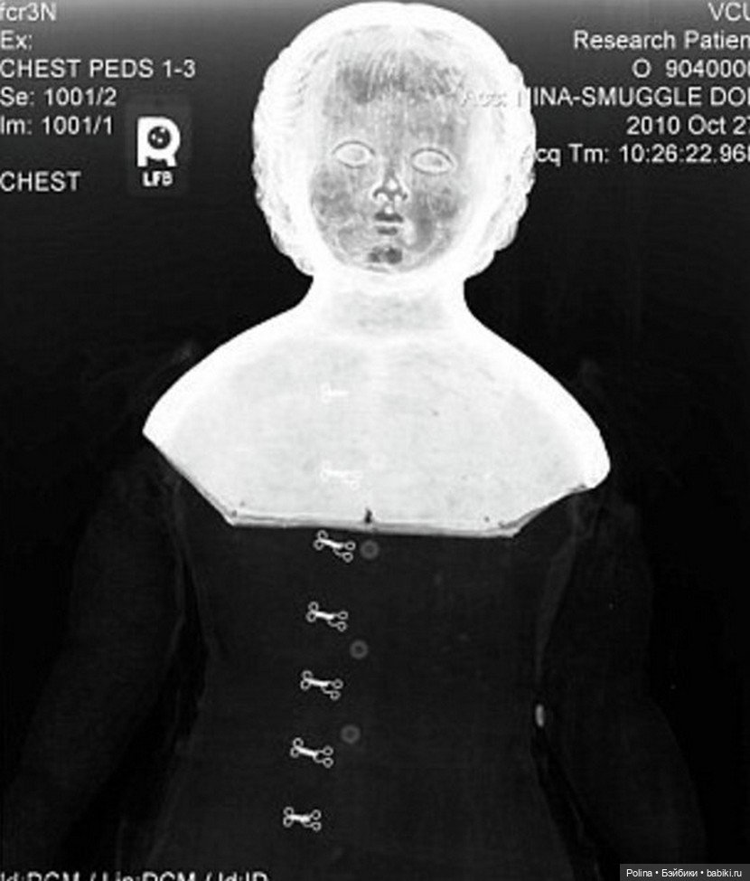 Загадочные куклы-путешественницы под рентгеном (фото 6)