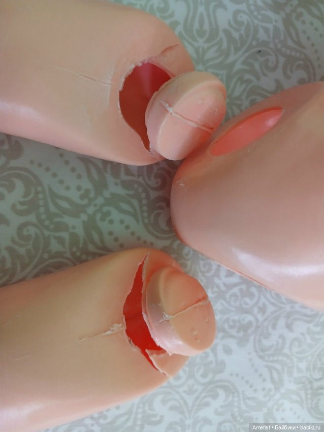 Эльдорадо из детсада: ремонт Незнайки-инвалида (фото 2)