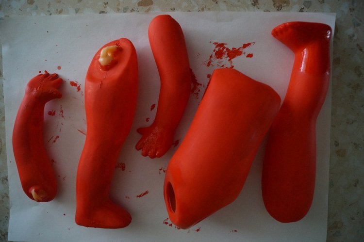 Четвёртая мартовская выписка. Машенька снова бегает и поёт! А перелом ноги исправлен за 10 минут (фото 7)