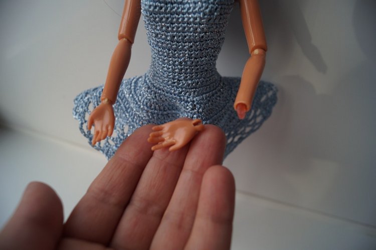 Третья выписка ноября. Лечим перелом колена, ставим донорские ручки. Анжелочка выздоровела + история-воспоминание о детском