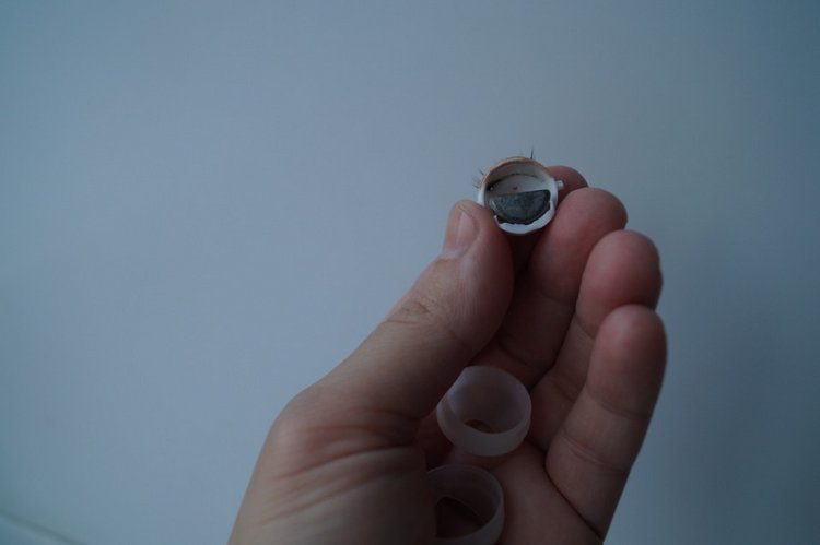 Вторая выписка января. Фарфоровая Снегурочка стала как новенькая. Зайчик снова видит. Как исправить западающий глазик у