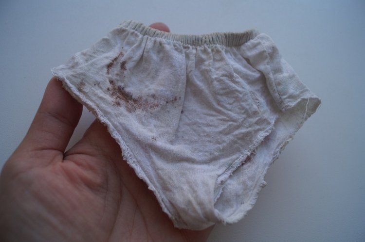 Вторая выписка августа. Потеря пальчика, ноги или стоп - это не беда, можно слепить. Кукла безнадёга стала красавицей | Бэйбики Вторая выписка августа. Потеря пальчика, ноги или стоп - это не беда, можно слепить. Кукла безнадёга стала красавицей