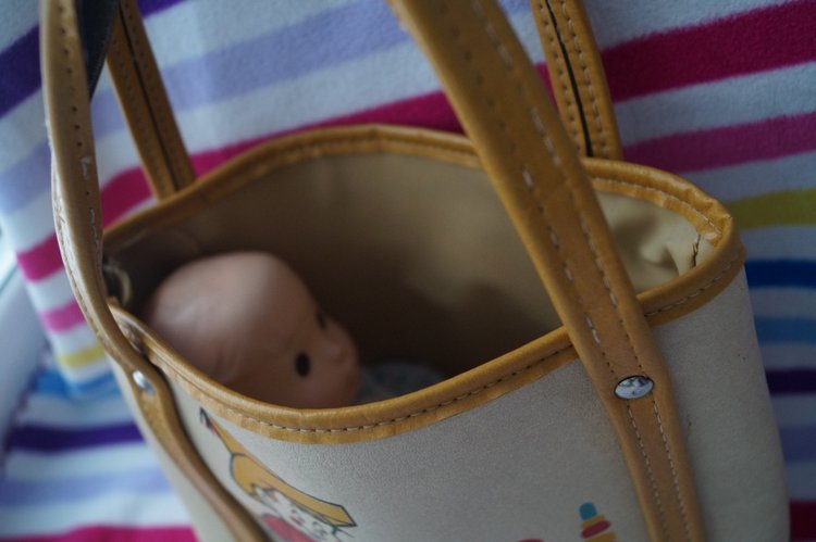 Третья выписка ноября. Лечим перелом колена, ставим донорские ручки. Анжелочка выздоровела + история-воспоминание о детском