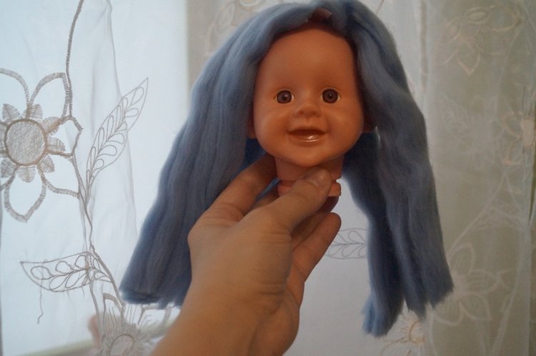 Субботняя выписка! У нейрохирурга снова была пациентка