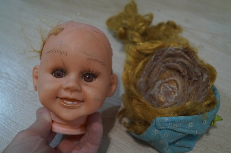 Субботняя выписка! У нейрохирурга снова была пациентка