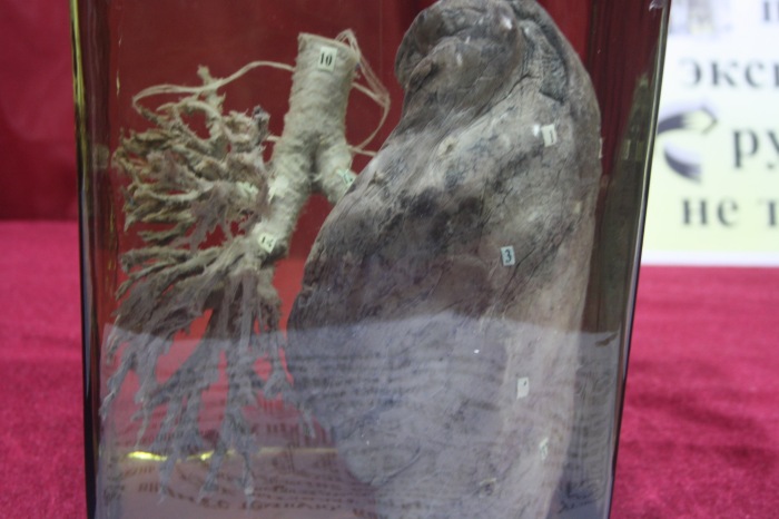 Псков: Петербургская Кунсткамера у нас в гостях. СТРОГО 18 +