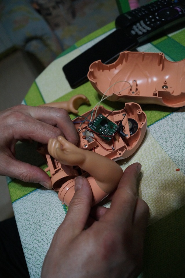 Третья выписка февраля. Сложная пациентка получила помощь нейрохирурга, бегемот Тотоша снова ловит шарики, лепка стоп +