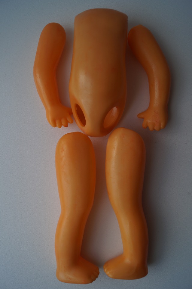 Четвёртая мартовская выписка. Машенька снова бегает и поёт! А перелом ноги исправлен за 10 минут