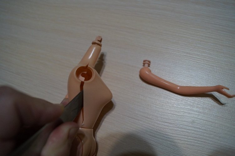 Вторая выписка декабря. Главная героиня нового года поправила своё здоровье. Лечим покусанные руки Барби, удаляем жир с