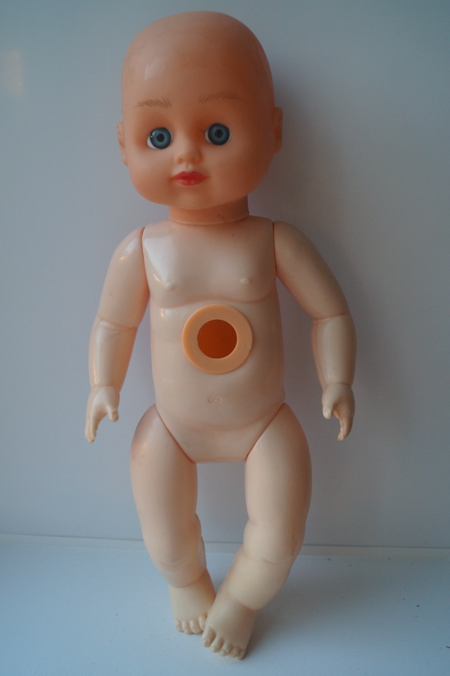 Вторая июльская выписка. Лечение глазок: отсутствие радужки, косоглазие. На лечении была ГДРочка. Голова+тело= красивая