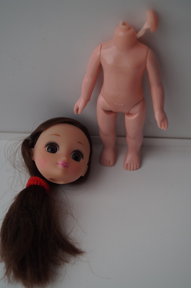 Третья выписка февраля. Сложная пациентка получила помощь нейрохирурга, бегемот Тотоша снова ловит шарики, лепка стоп +