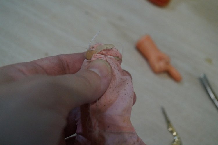 Субботняя выписка! У нейрохирурга снова была пациентка