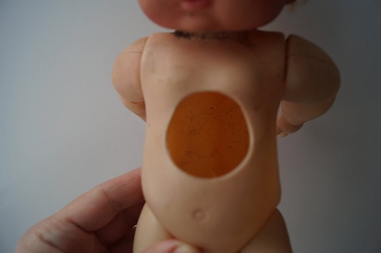 Четвёртая мартовская выписка. Машенька снова бегает и поёт! А перелом ноги исправлен за 10 минут