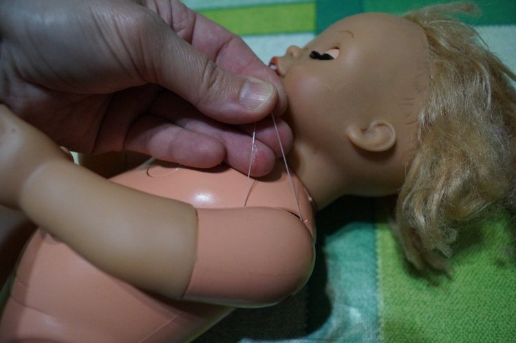 Третья выписка февраля. Сложная пациентка получила помощь нейрохирурга, бегемот Тотоша снова ловит шарики, лепка стоп +