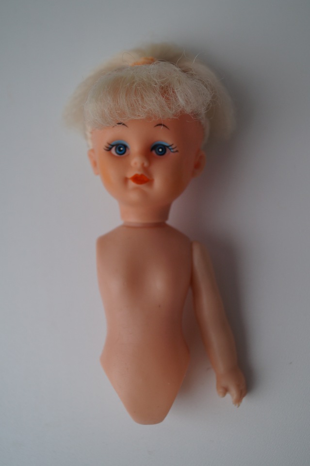 Третья выписка ноября. Лечим перелом колена, ставим донорские ручки. Анжелочка выздоровела + история-воспоминание о детском