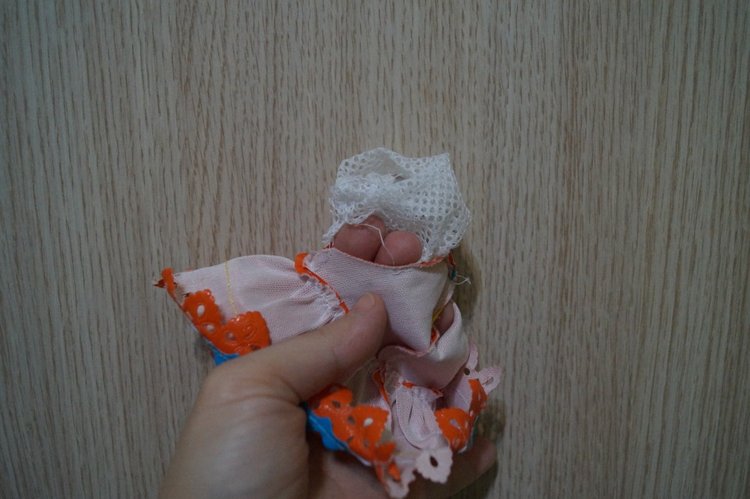 Третья выписка ноября. Лечим перелом колена, ставим донорские ручки. Анжелочка выздоровела + история-воспоминание о детском