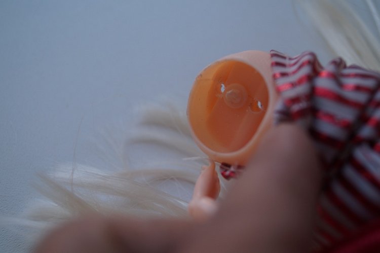 Вторая выписка сентября. Ещё одна поломка тазобедренных суставов и как её легко исправить