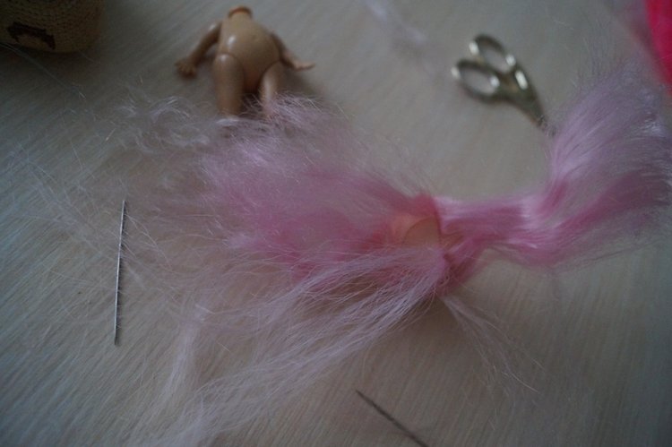 Вторая выписка декабря. Главная героиня нового года поправила своё здоровье. Лечим покусанные руки Барби, удаляем жир с