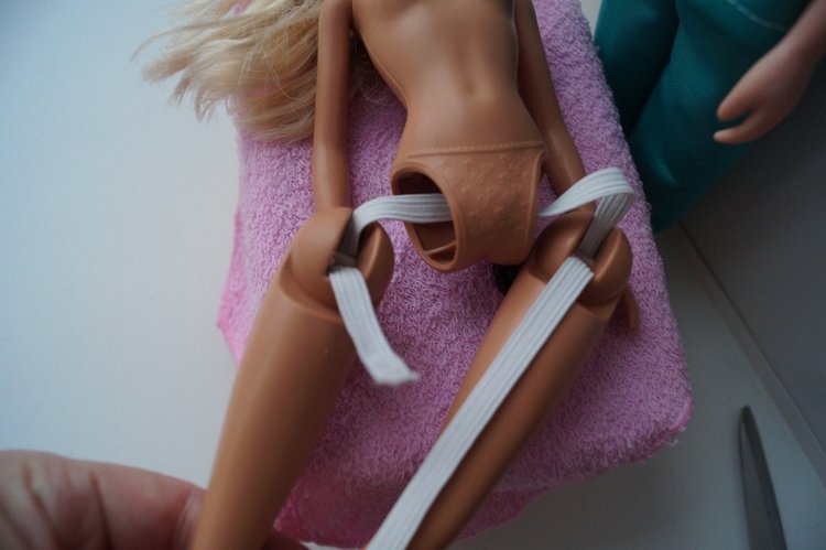 Четвёртая выписка декабря. Лечение тазобедренных суставов Барби. Четверо новогодних героев поправили своё здоровье.