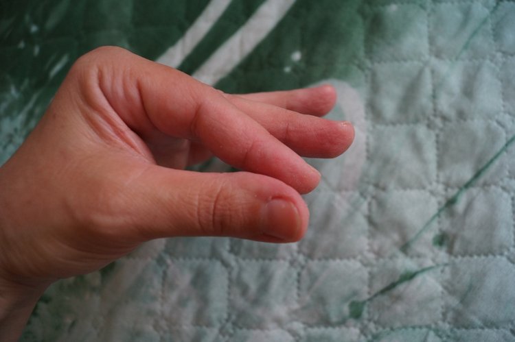 Куколки здоровы - пора выписываться