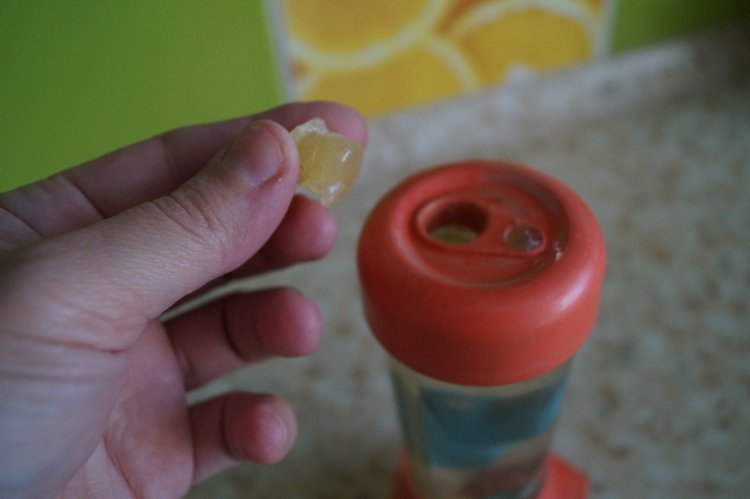 Третья выписка февраля. Сложная пациентка получила помощь нейрохирурга, бегемот Тотоша снова ловит шарики, лепка стоп +