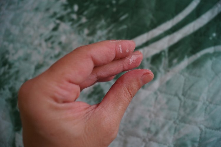 Куколки здоровы - пора выписываться